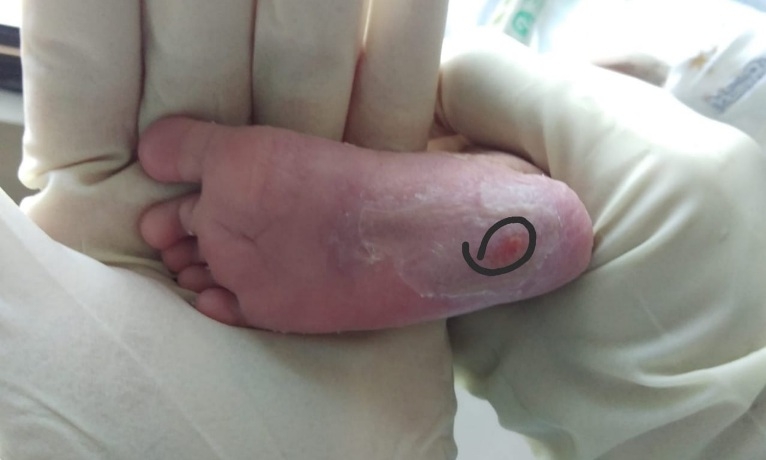 Polisi Periksa 3 Dokter RSU Mitra Medika Kasus Dugaan Malpraktek Bayi